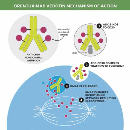 R/R PMBL 納武利尤單抗聯(lián)合Brentuximab vedotin有效
