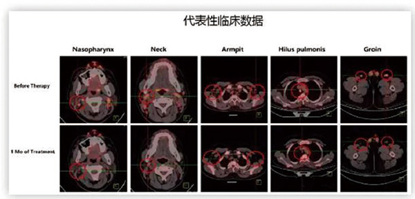 256-257期《全球腫瘤快訊》-89.jpg