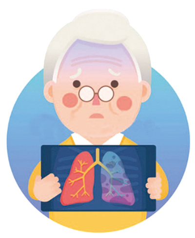 NSCLC或SCLC的腦轉(zhuǎn)移 部分≥75歲者也可SRS