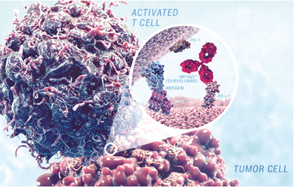 依托泊苷為基礎一線治療 ES-SCLC 聯(lián)合 Durvalumab 或阿替利珠單抗或為最優(yōu)選