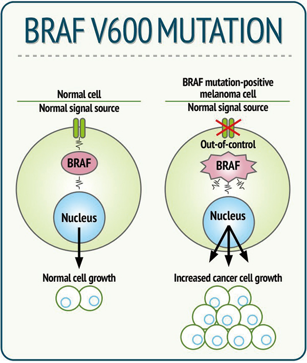 BRAF V600突變晚期黑色素瘤 一線抗PD-1單藥優(yōu)于BRAF/MEK抑制劑