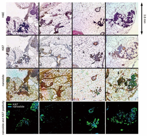 289-290期《全球腫瘤快訊》-31.jpg