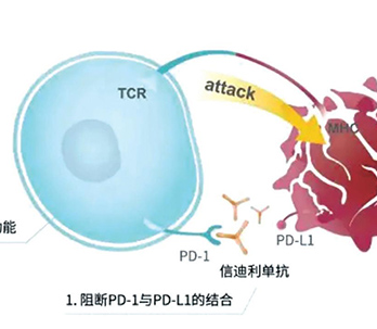 無(wú)EGFR/ALK改變的AMnsqNSCLC 一線化療聯(lián)用信迪利單抗顯著改善OS