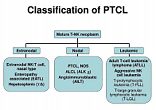 PTCL患者首次緩解后 帕博利珠單抗鞏固治療有效
