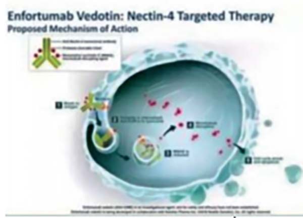  一線治療不宜順鉑的la/mUC Enfortumab vedotin聯(lián)合帕博利珠單抗緩解率高