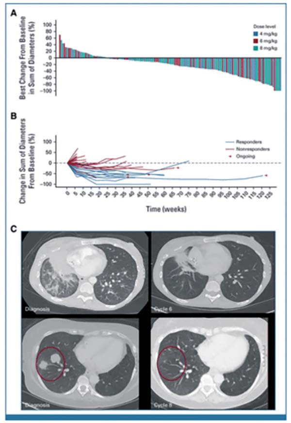 多線治療失敗的晚期NSCLC Dato-DXd有抗瘤活性且安全性可控
