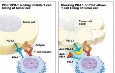晚期NSCLC二線治療 Nivolumab、Pembrolizumab、Atezolizumab孰優(yōu)孰劣?