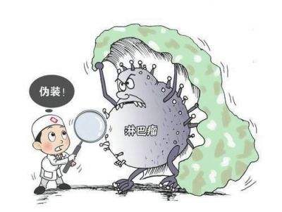 Ⅲ期或Ⅳ期霍奇金淋巴瘤 A+AVD方案與ABVD方案的較量