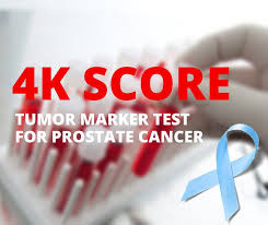 4Kscore可對(duì)PSA輕度增高人群重新分類