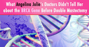 BRCA1與BRCA2 突變攜帶者的雙側(cè)乳房切除術(shù)