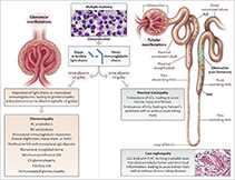 肺癌術(shù)后急性腎損傷發(fā)生率及預(yù)測因素研究