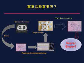 一線TKI治療后二次活檢率分析