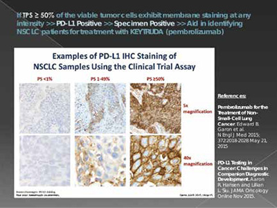 真實世界ⅢB/Ⅳ期NSCLC PD-L1 TPS≥50%和TPS≥1%無區(qū)域差異