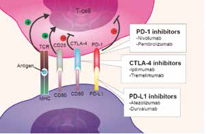 晚期胃食管交界癌 Durvalumab、Tremelimumab單用或聯(lián)用的安全性和療效