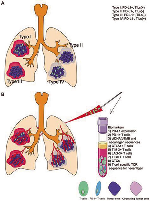 合并HBV/HCV NSCLC免疫療法似安全有效