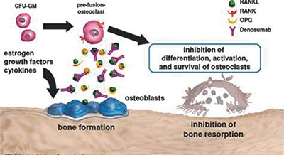 含鉑雙藥一線治療晚期NSCLC 聯(lián)合地諾單抗未改善OS