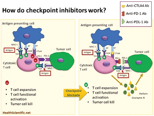 NSCLC 合并ILD者仍可用免疫檢查點抑制劑