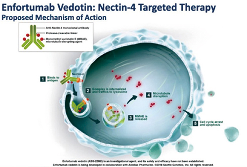 經(jīng)治的晚期尿路上皮癌 Enfortumab vedotin 對比標準化療可延長生存
