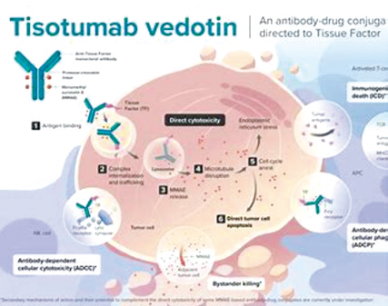 Tisotumab vedotin治療轉(zhuǎn)移性宮頸癌的療效和安全性研究