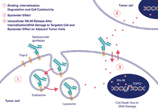 后線治療mUC Sacituzumab govitecan或安全有效