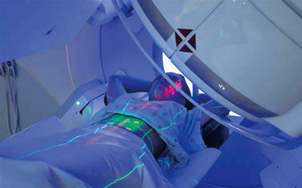 早期NSCLC 不連續(xù)SBRT顯著改善局部控制和總生存