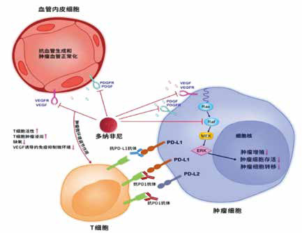 不可切除/轉(zhuǎn)移性肝癌 多納非尼一線治療優(yōu)于索拉非尼 