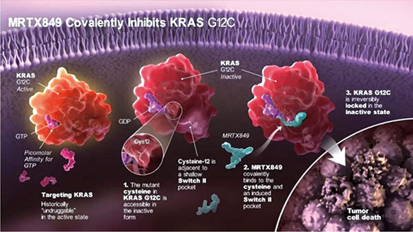研究發(fā)現(xiàn)腫瘤可從腺癌變鱗癌而對KRAS抑制劑耐藥