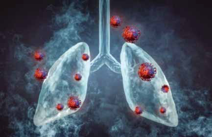 晚期NSCLC ICI逾6個月者非癌因停藥仍有獲益