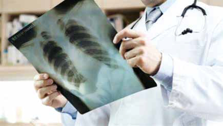 輔助治療NSCLC 吉非替尼對(duì)比化療預(yù)防早期復(fù)發(fā)