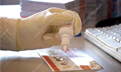 英國結(jié)直腸癌 兩年一次的便潛血篩查可降低死亡率 