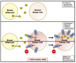 HER2陽性乳腺癌 CD36高表達(dá)預(yù)測(cè)新輔助曲妥珠單抗結(jié)局較差