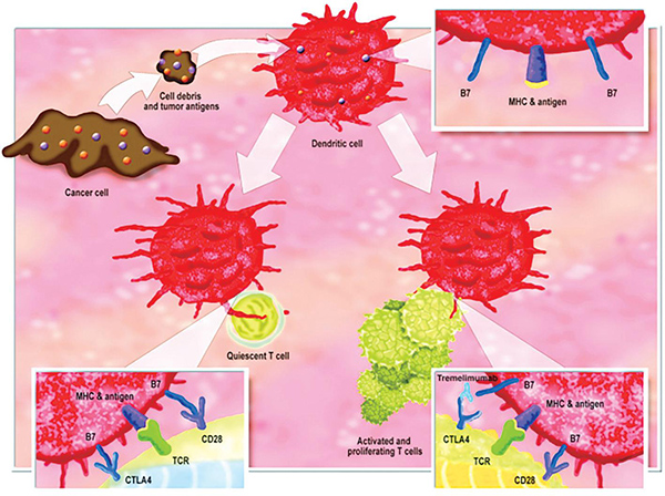 STK11、KEAP1、KRAS突變的肺鱗癌 一線化療聯(lián)合Tremelimumab、度伐利尤單抗或改善生存