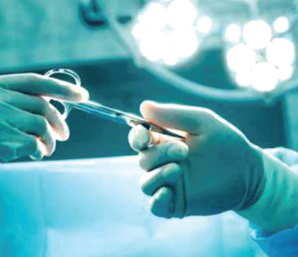 局部晚期胃癌 腹腔鏡手術非劣于開放式胃切除術