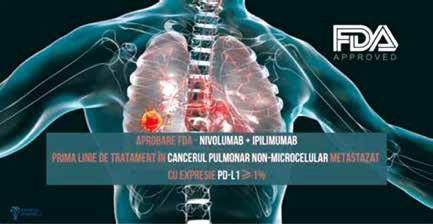 一線治療晚期NSCLC 納武利尤單抗聯(lián)合伊匹單抗有長(zhǎng)期生存獲益