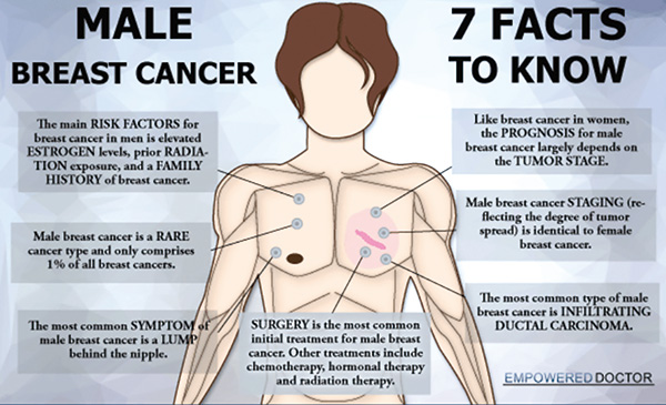 30年來(lái)男性乳腺癌患者的生存分析研究