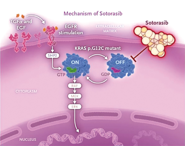 經(jīng)治的、KRAS G12C突變的NSCLC Sotorasib對(duì)比多西他賽顯著改善PFS