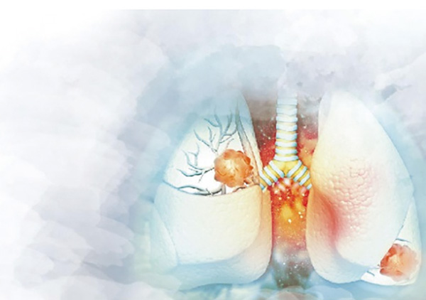 METex14跳躍突變的NSCLC Tepotinib初治或復(fù)治時(shí)的療效穩(wěn)健而持久