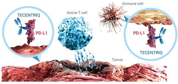 PD-L1 TC≥50%的Ⅱ~ⅢA期NSCLC 輔助治療時(shí)聯(lián)用阿替利珠單抗生存獲益或更大