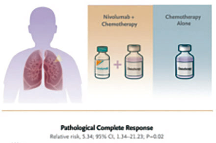 可切除的ⅢA/ⅢB期NSCLC 圍手術(shù)期治療添加納武利尤單抗或更優(yōu)