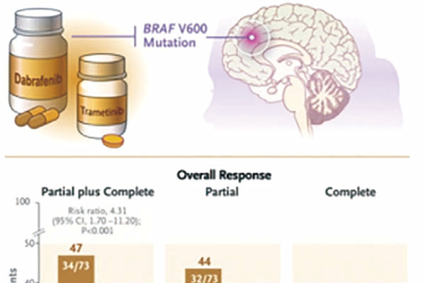 BRAF V600突變的低級(jí)別膠質(zhì)瘤患兒 一線(xiàn)應(yīng)用達(dá)拉非尼聯(lián)用曲美替尼或優(yōu)于標(biāo)準(zhǔn)化療