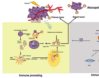 PD-L1 TPS≥50%局部晚期NSCLC 僅予放射免疫治療而不予化療或更佳