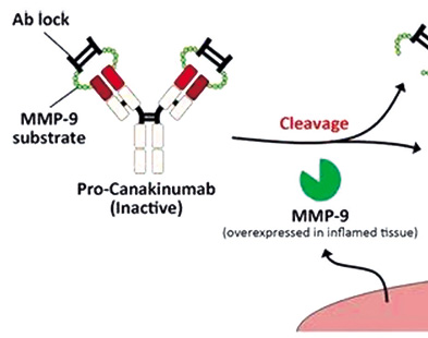 無敏感突變的晚期/轉(zhuǎn)移性NSCLC 一線帕博利珠單抗聯(lián)合含鉑雙藥不必加用Canakinumab