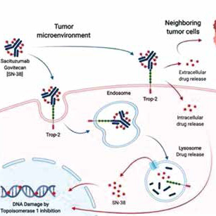 局部三陰性乳腺癌 Sacituzumab govitecan單藥有效 