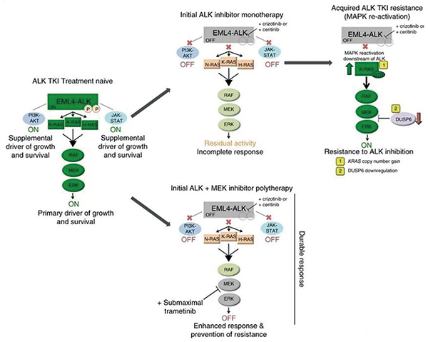 ALK陽(yáng)性晚期NSCLC 第二代ALK TKI耐藥后Ficonakib或安全有效