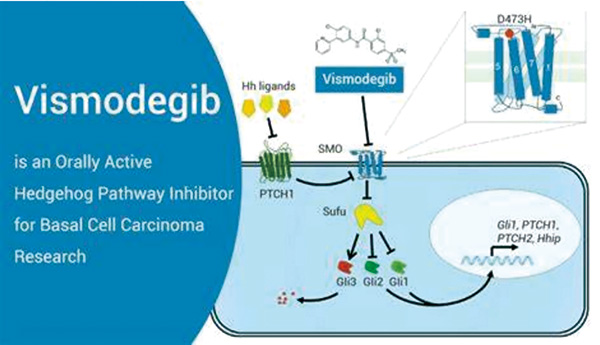 頭頸部局部晚期基底細(xì)胞癌 Vismodegib聯(lián)合放療1年局部控制率達(dá)91%