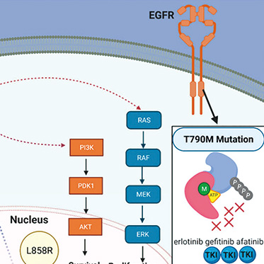 EGFR變異的NSCLC 吉非替尼聯(lián)合化療有長(zhǎng)期的生存獲益