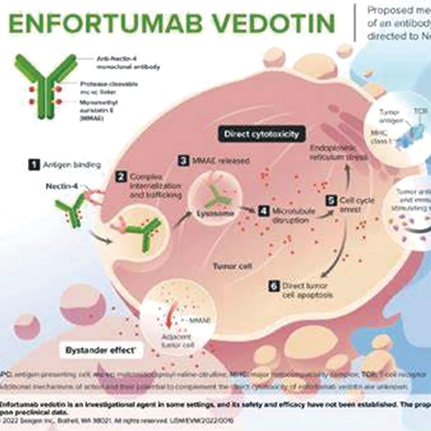 轉(zhuǎn)移性尿路上皮癌 NECTIN4擴(kuò)增常見且可預(yù)測Enfortumab vedotin療效