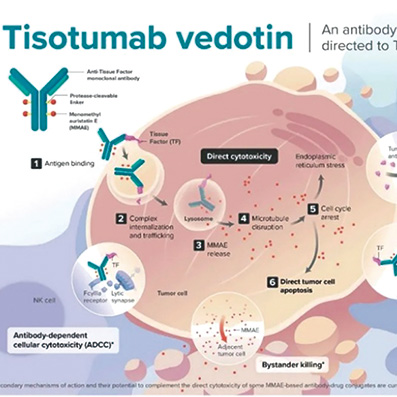 EGFR野生型非鱗狀NSCLC c-Met過表達者后線應用Teliso-V有持久緩解