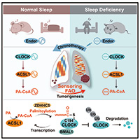 睡眠不足加速腫瘤生長？