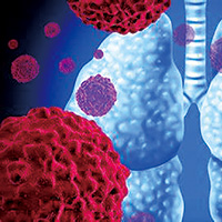 奧希替尼一線治療失敗的NSCLC 特泊替尼聯(lián)合奧希替尼對MET擴增者有效 